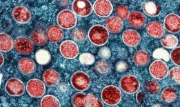 泰国记录了亚洲首例传染性m痘病例