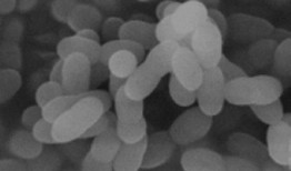 新的“纳豆”发酵豆制品中含有增强免疫系统的细菌