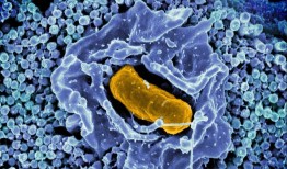 研究发现了一种蛋白质系统如何帮助沙门氏菌在巨噬细胞内存活