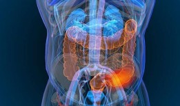 粪便免疫化学试验筛选发现可降低结直肠癌死亡风险