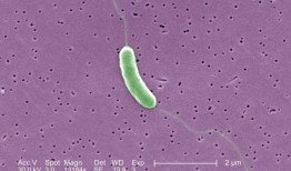 疾病预防控制中心就食肉细菌发布全国健康警报