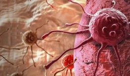 无创产前检查提示母体恶性肿瘤