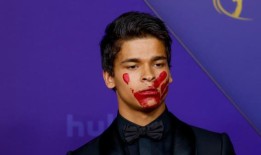 艾美奖红毯声明：为什么年轻明星“法老”云阿泰在电视最盛大的夜晚涂了红脸